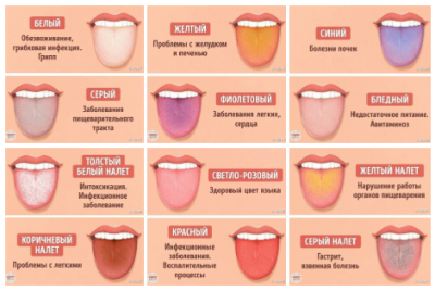 Как выявить проблемы со здоровьем по цвету языка.png