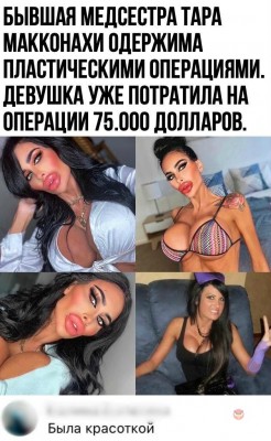 Была красавицей, а стала чудовищем..jpg